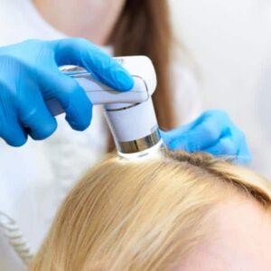 Hair Loss Consultations
