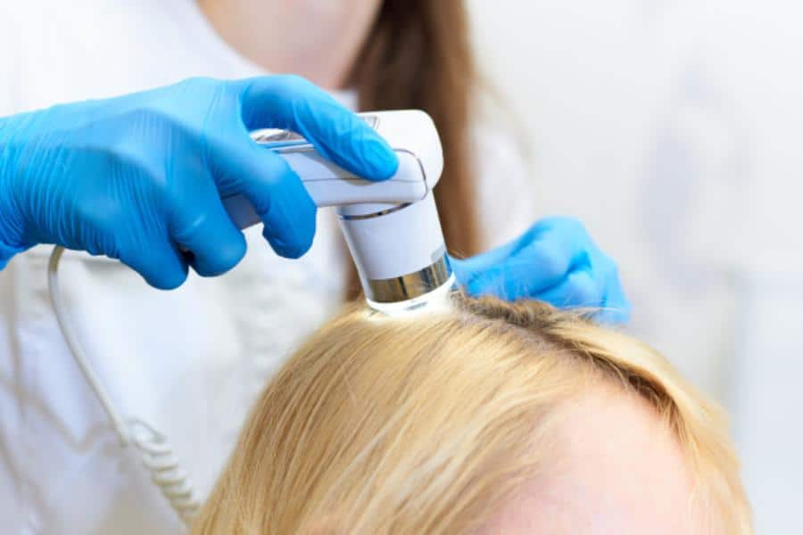 Hair Loss Consultations